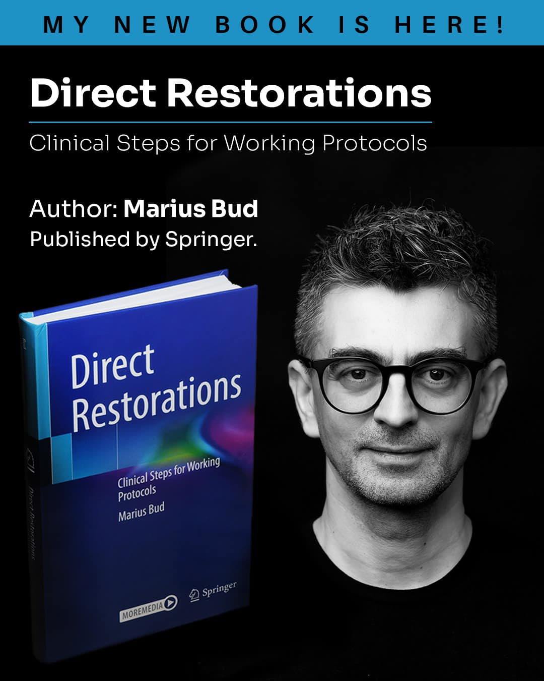 Cartea de restaurari directe publicata de dr. Marius Bud la editura Springer in Elvetia in limba engleaza in anul 2024. In prezent cartea este publicata si in limba romana (UMF Cluj Napoca) si in limba spaniola (editura Lisermed, valencia)
